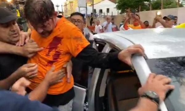 Senador Cid Gomes leva tiro durante protesto no Ceará Senador Cid Gomes leva tiro durante protesto no Ceará