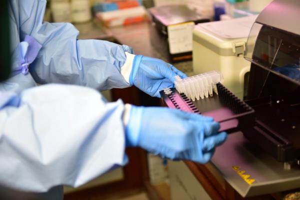 Casos de Covid-19 no Amazonas totalizam 4.801, com 464 novos registros nas últimas 24 horas