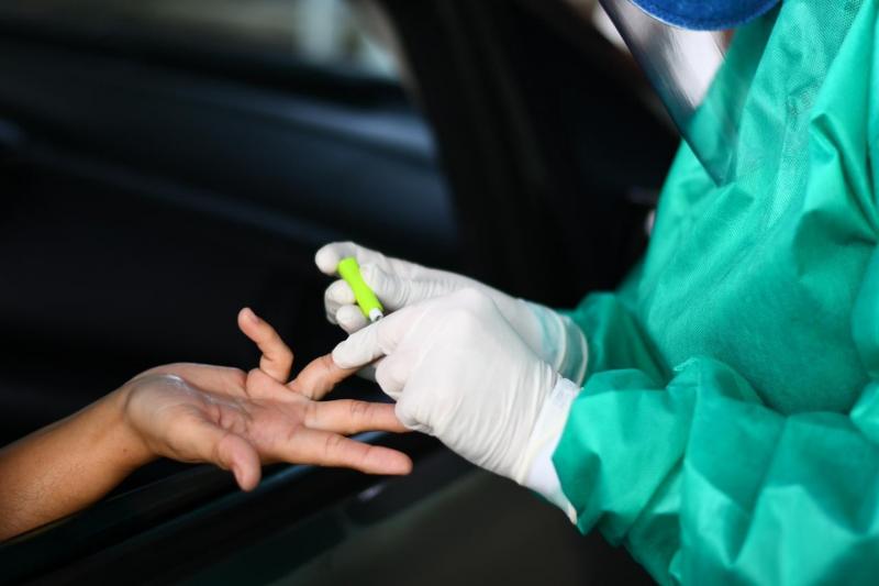 Amazonas chega a 10.099 infectados de coronavírus 