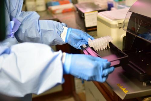 Governo do Amazonas oferta mais testes no interior, ampliando rede de diagnóstico de Covid-19