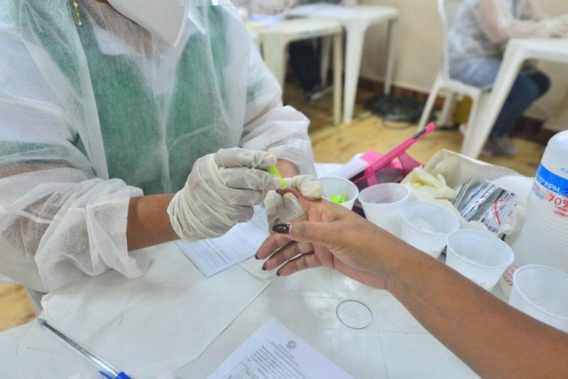 Amazonas está entre os estados brasileiros que mais realizam testes para Covid-19