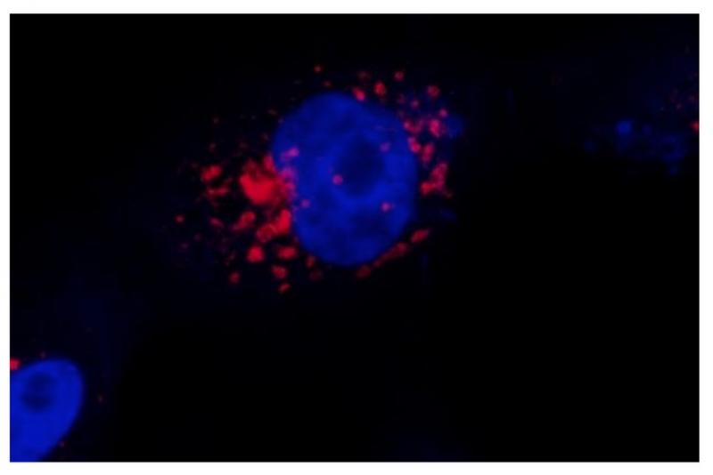 Cientistas brasileiros desenvolvem técnica de baixo custo que permite ver em 3D o novo coronavírus dentro da célula Cientistas brasileiros desenvolvem técnica de baixo custo que permite ver em 3D o novo coronavírus dentro da célula