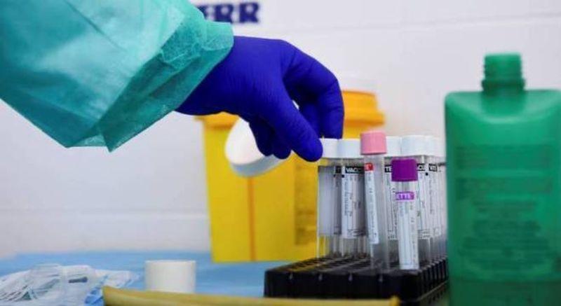 Prefeitura de Manaus já encerrou investigação de 20% dos casos de óbitos de SRAG por causa não especificada