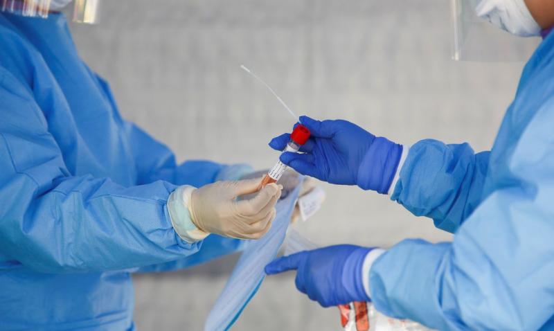 Médica é o primeiro caso de reinfecção por covid-19 no país