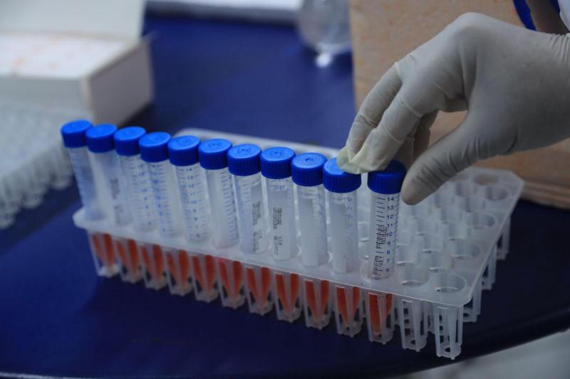 FVS-AM realiza testagem em professores e servidores da rede de ensino particular