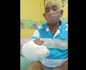 Jacaré ataca pescador de 72 anos em Barreirinha 