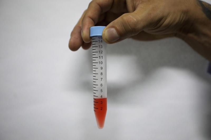 Governo do Amazonas intensifica monitoramento de casos de Covid-19 no interior com distribuição de testes RT-PCR