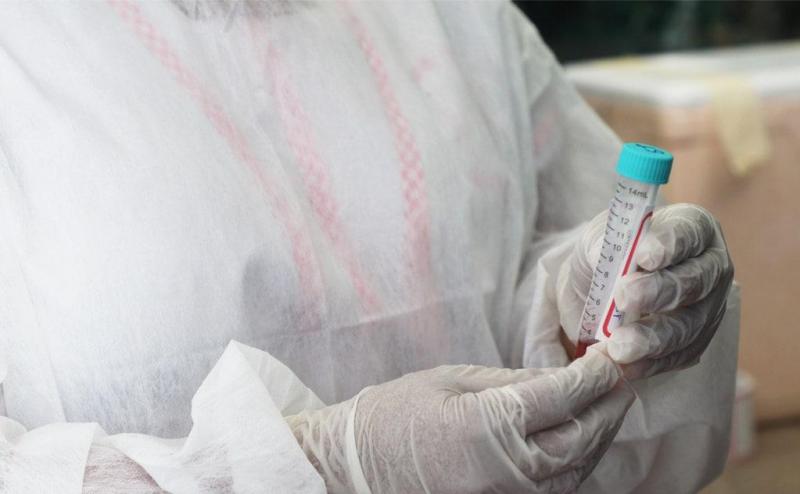 Situação Epidemiológica da Covid-19 no Amazonas é atualizada pela FVS-AM, nesta sexta-feira (25/06)