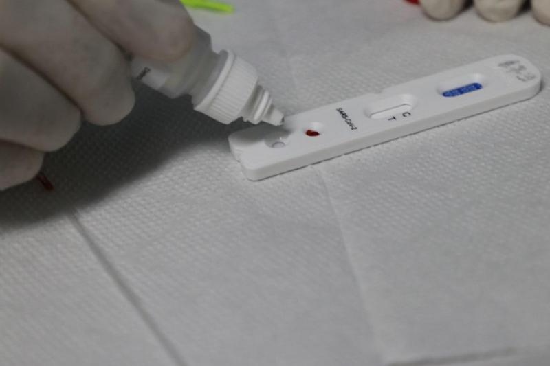 Nota Técnica da FVS-RCP restringe Teste Rápido de Anticorpos a diagnóstico de SIM-P