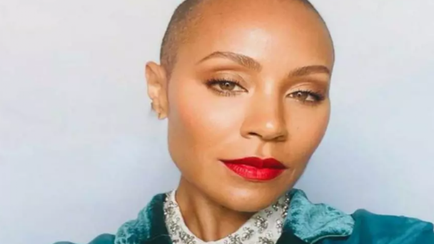 O que é alopecia, doença de Pinkett Smith que fez Will Smith dar um tapa em Chris Rock?