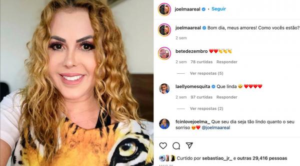 Joelma Calypso brinca com suporte de soro no hospital, cantora segue internada para tratar sequelas da covid19