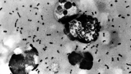 Análise de DNA revela possível local de origem da Peste Negra