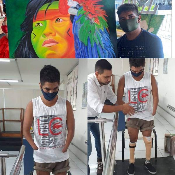 Artista Lúcio que tem deficiência múltipla pede ajuda para continuar tratamento em Manaus Artista Lúcio que tem deficiência múltipla pede ajuda para continuar tratamento em Manaus