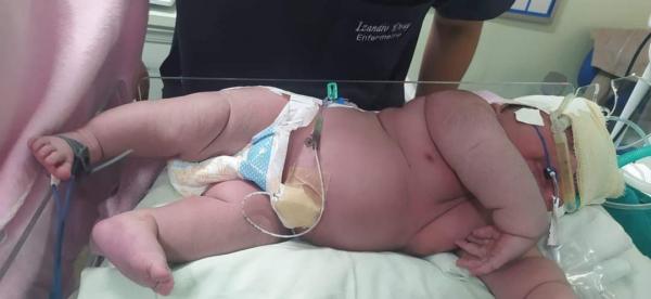 Bebê gigante nasce com 7,3 quilos em Parintins é o maior recém nascido no Amazonas