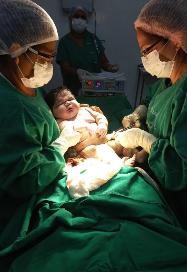 No Hospital Padre Colombo, maternidade de Parintins, SES-AM registra o nascimento do maior bebê do Amazonas 