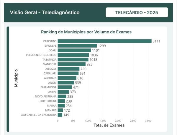 Parintins já realizou mais de três mil exames de eletrocardiograma por Telessaúde de 2025