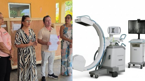 Gestão Mateus e Vanessa recebe arco cirúrgico de R$ 1 milhão e amplia capacidade do Hospital Jofre Cohen